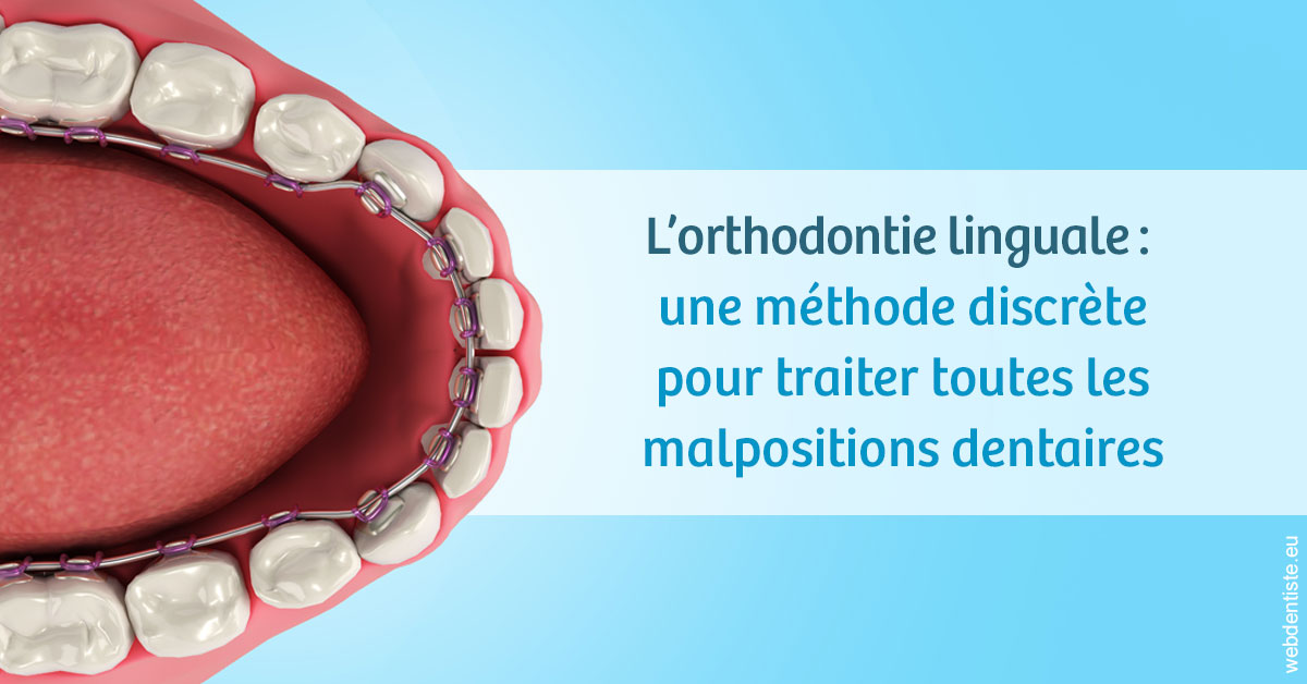 https://dr-madar-fabrice.chirurgiens-dentistes.fr/L'orthodontie linguale 1