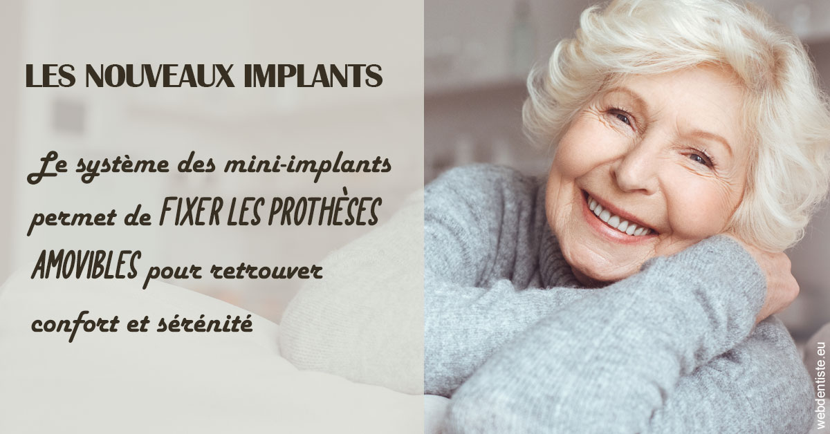 https://dr-madar-fabrice.chirurgiens-dentistes.fr/Les nouveaux implants 1