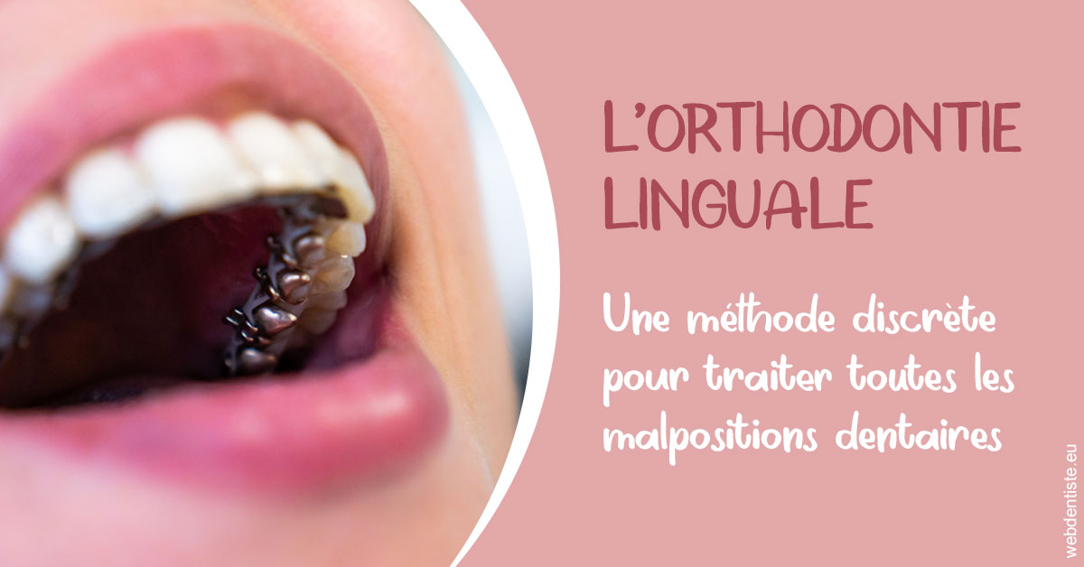 https://dr-madar-fabrice.chirurgiens-dentistes.fr/L'orthodontie linguale 2