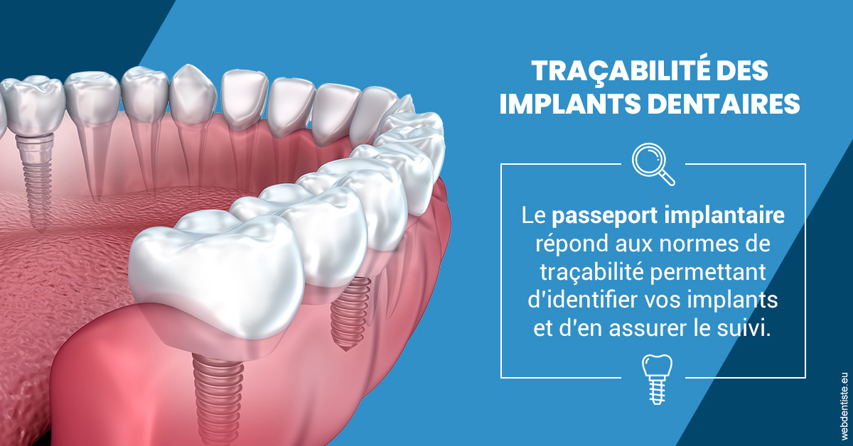https://dr-madar-fabrice.chirurgiens-dentistes.fr/T2 2023 - Traçabilité des implants 1