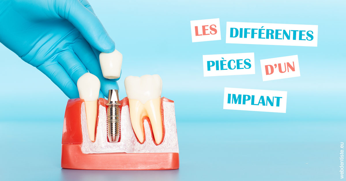 https://dr-madar-fabrice.chirurgiens-dentistes.fr/Les différentes pièces d’un implant 2