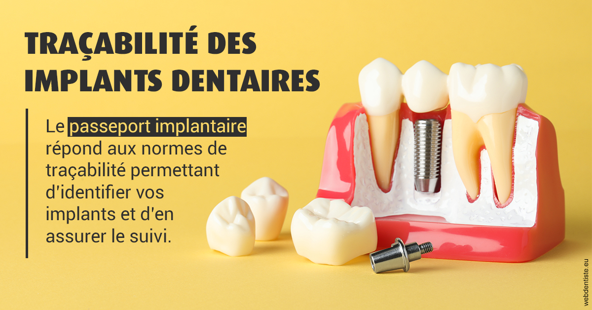 https://dr-madar-fabrice.chirurgiens-dentistes.fr/T2 2023 - Traçabilité des implants 2