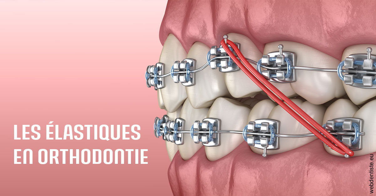 https://dr-madar-fabrice.chirurgiens-dentistes.fr/Elastiques orthodontie 2