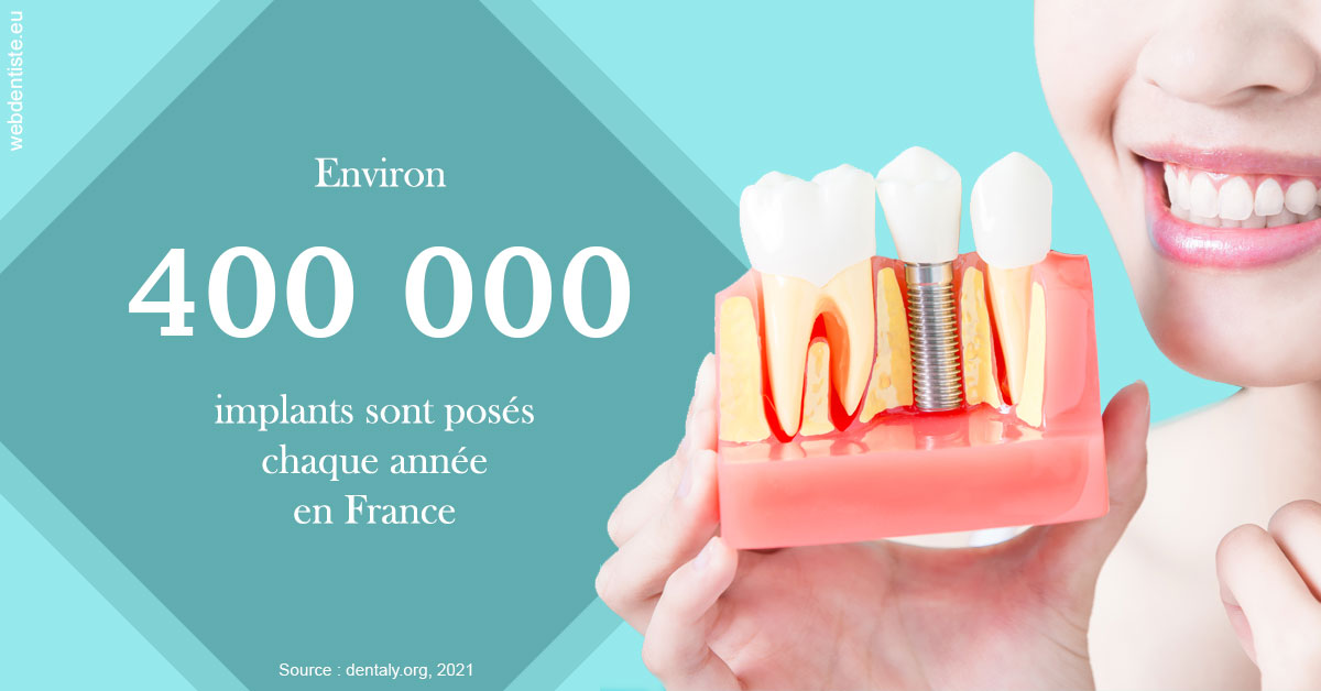 https://dr-madar-fabrice.chirurgiens-dentistes.fr/Pose d'implants en France 2